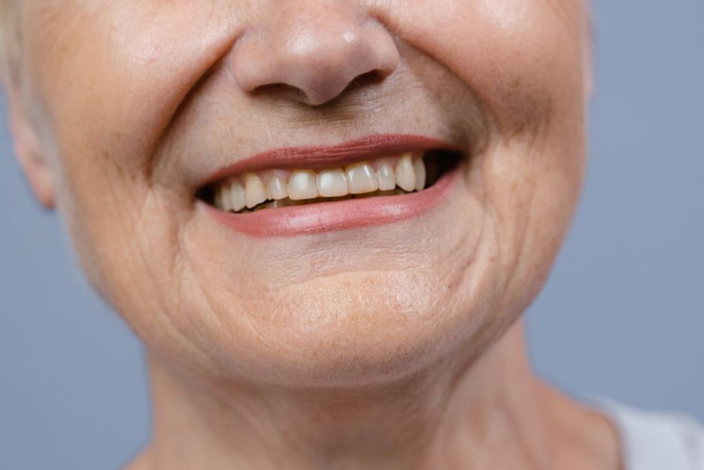 old teeth